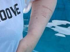 나의 자해와 주변인들의 반응