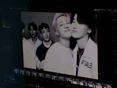 선천적 다정의 부작용