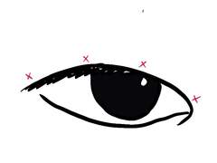 토왜 쌍수후기 (안검하수, 절개) +3개월후 후기 추가