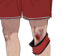 그냥.......정대만 무릎