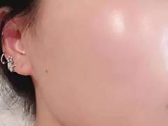 홈케어로 단기간에 여드름 조지기