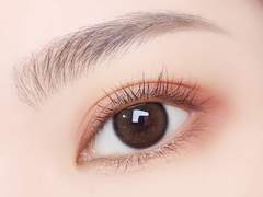 망한 렌즈삽입술 찐후기 (+라식 라섹)