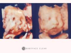 사실 아기가 너무 잘 커서 놀라고 있습니다.