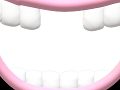 앞니 없는 투명 포카 프레임