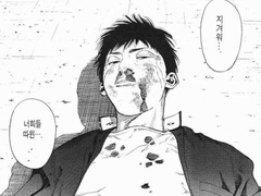 산왕즈 수면마취썰