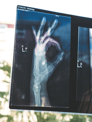 자위에 관한 4가지 단상