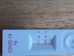 팔 봉합했는데 코로나 걸린썰