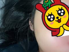 민감성 여드름성 스킨케어