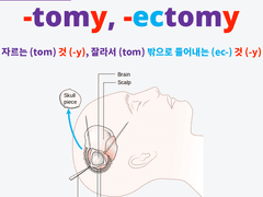 -tomy, -ectomy