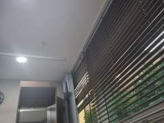 어떤 수술 후기