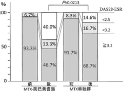 [내과] 류마티스관절염의 한의학적 치료