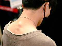 죽은 생선의 아니사키스