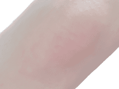 느릿느릿 팔꿈치와 무릎 착색을 관리하는 습관들