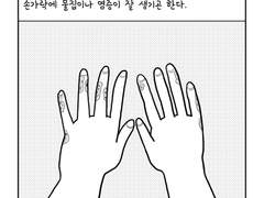 20. 한포진