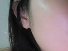 2주만에 피부 좋아지는법 (비포&에프터 사진있음)