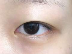 성형은 안하는게 좋은거같다