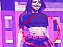 나의 섭식장애. 첫번째 거식.