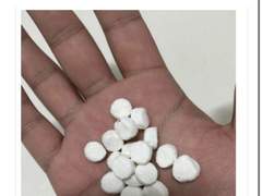 잔트 15개 먹고 수술한 썰