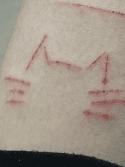 나의 옛날 우울 이야기