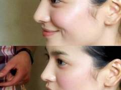 꿀피부 되고 싶은 사람 손.