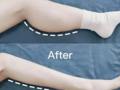 종아리 알 -> 싹 다 빼는 방법