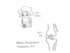 1. 인대가 파열되었다