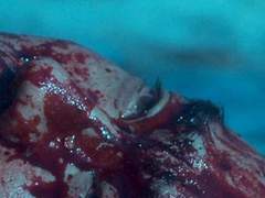 1. 다치지 않는 남자