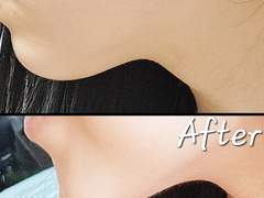 단기간에 턱살빼는법(+턱선 예뻐지는법) 사진 둘다 본인임