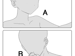 고정틀 애니 [첫 눈 타입]