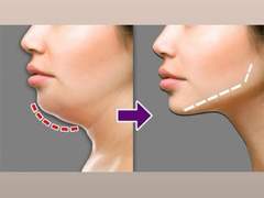 이중턱 박멸하고 연예인 얼굴형 되는법