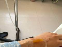 알바 가다 차에 치여서 입원했는데 도중에 맹장염 걸려서 총 보름 간 입원한 이야기 1