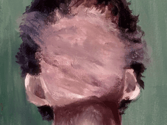 코넬리아 다란지 증후군