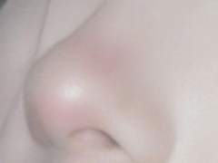 chapter 1. 성형없이 얼굴 비대칭 교정 하기